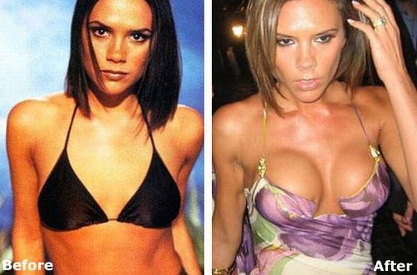 4-Victoria-Beckham
