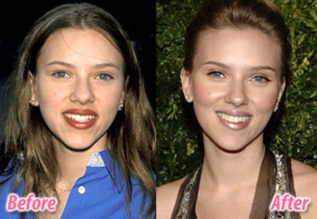 scarlett johansson